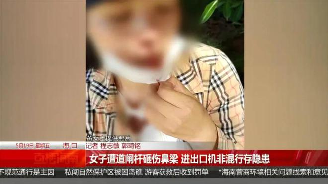 365游戏娱乐平台女子骑车鼻梁被道闸杆砸骨折进出口机非混行存隐患→