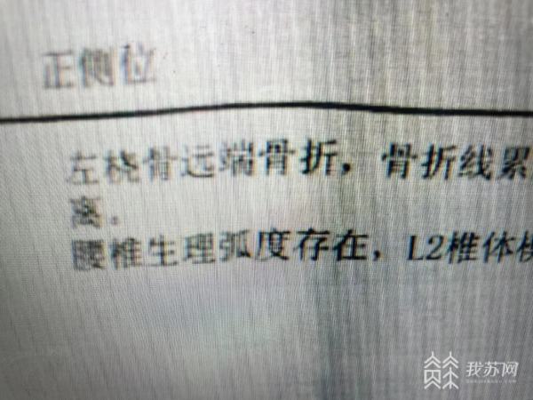 365游戏娱乐骑车随前人出小区被电动门撞伤 责任谁承担？(图1)